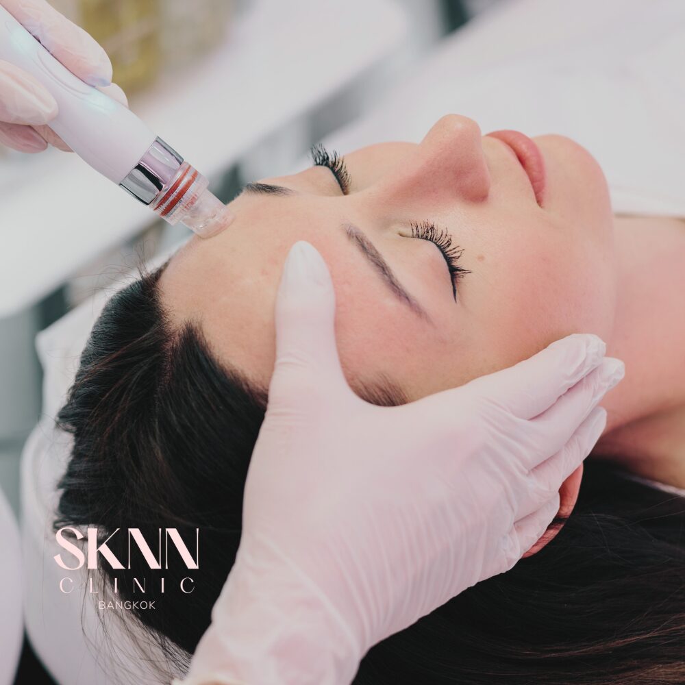 Hydra Facial