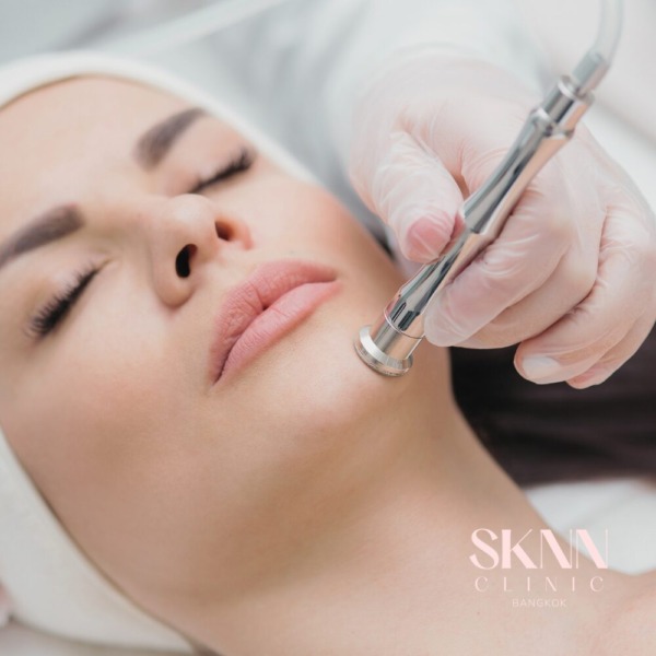 Microdermabrasion